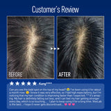 ViveLab Intensive Scalp Care Set – 220,000 Spioxyl™ 400 Shot Scalp Ampoule & Hair Enhancing Foam | Revitalizes Scalp and Strengthens Hair for a Fuller, Healthier Look