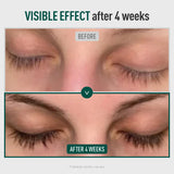 ViveLab All Day Lash Care Set – Hyper Curling Black Day Serum + Revive Therapy Night Serum