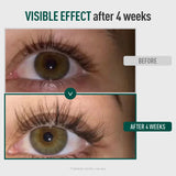 Eyelash & Brow Enhancing Serum – Strengthening & Conditioning Formula for Thicker, Longer, Fuller, and Healthier-Looking Lashes & Brows (0.34 Oz)