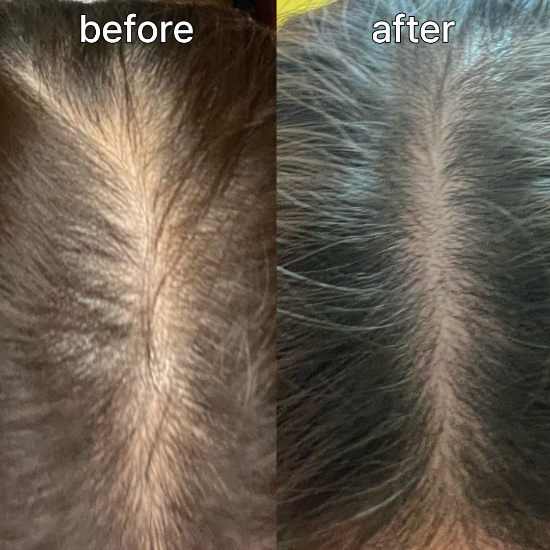 Vivelab Scalp & Hair Serum for Thinning Hair (15ml) – Clinically Tested, Nourishing Formula with Biotin & Peptides for a Healthy Scalp & Fuller-Looking Hair - ViveLab