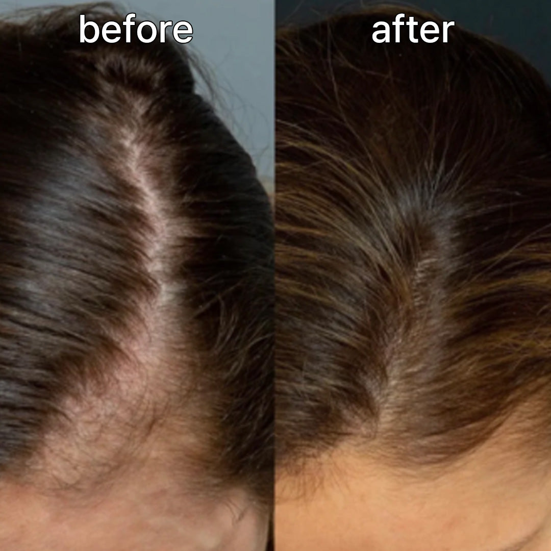 Vivelab Scalp & Hair Serum for Thinning Hair (15ml) – Clinically Tested, Nourishing Formula with Biotin & Peptides for a Healthy Scalp & Fuller-Looking Hair - ViveLab