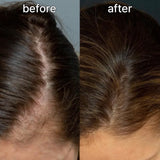 Vivelab Scalp & Hair Serum for Thinning Hair (15ml) – Clinically Tested, Nourishing Formula with Biotin & Peptides for a Healthy Scalp & Fuller-Looking Hair - ViveLab