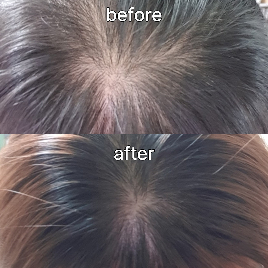 Vivelab Scalp & Hair Serum for Thinning Hair (15ml) – Clinically Tested, Nourishing Formula with Biotin & Peptides for a Healthy Scalp & Fuller-Looking Hair - ViveLab