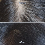 ViveLab Spioxyl™ React Shot 800 – 1.6 Million Microneedle Formula for Thicker, Fuller Hair & Scalp Renewal | Korea’s Best-Selling Dermatologist-Recommended K-Beauty Serum (1.69 fl oz)