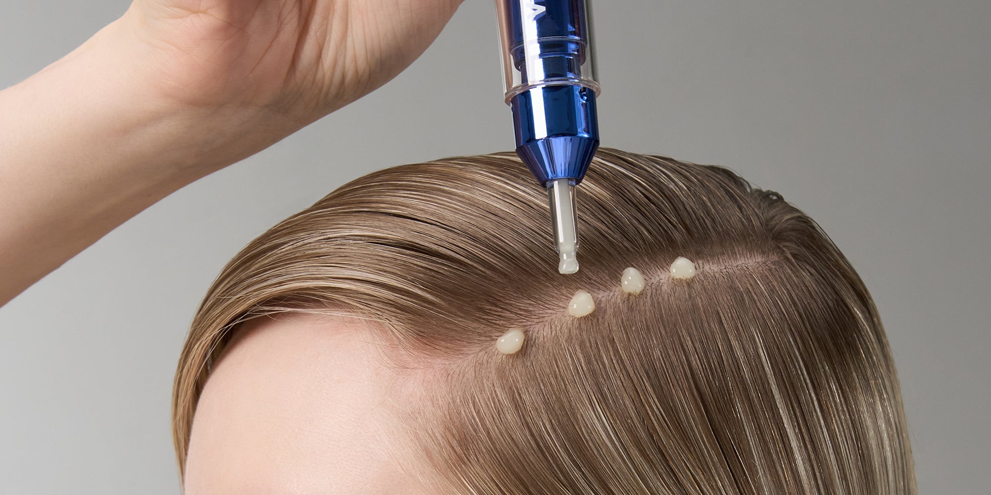 HAIR & SCALP