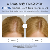 Scalp Spioxyl™ React Shot 400 – 220,000 Microneedle Formula for Visible Scalp Vitality and Fuller-Looking Hair (0.5 fl oz)