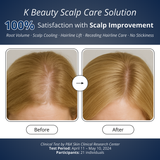 Scalp Spioxyl™ React Shot 800 – 1.6 Million Microneedle Formula for Fuller, Stronger, and Healthier-Looking Hair & Scalp (1.69 fl oz)
