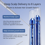 Scalp Spioxyl™ React Shot 400 – 220,000 Microneedle Formula for Visible Scalp Vitality and Fuller-Looking Hair (0.5 fl oz)