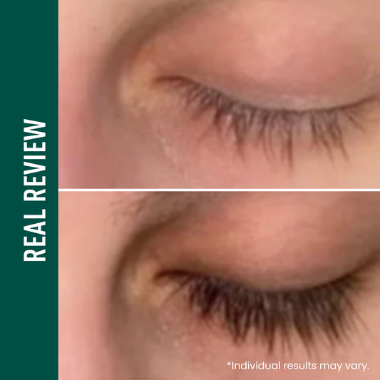 Eyelash & Brow Enhancing Serum – Strengthening & Conditioning Formula for Thicker, Longer, Fuller, and Healthier-Looking Lashes & Brows (0.34 Oz)