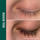 Eyelash & Brow Enhancing Serum – Strengthening & Conditioning Formula for Thicker, Longer, Fuller, and Healthier-Looking Lashes & Brows (0.34 Oz)