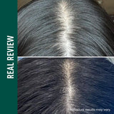 Vivelab Scalp & Hair Serum for Thinning Hair (15ml) – Clinically Tested, Nourishing Formula with Biotin & Peptides for a Healthy Scalp & Fuller-Looking Hair