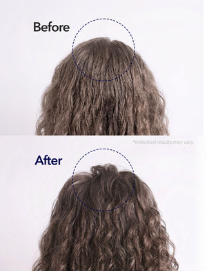 Spioxyl 400 & Micro Foam Scalp Deep Repair Duo