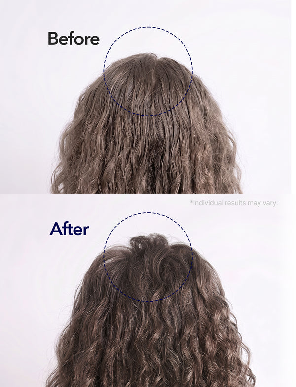 Spioxyl 400 & Micro Foam Scalp Deep Repair Duo