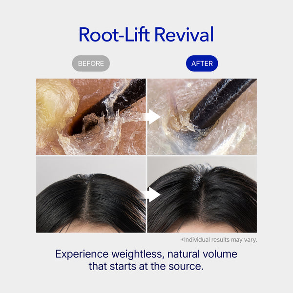 [Buy 1 Get 1] Spioxyl 400 Microneedling Hair Growth Serum