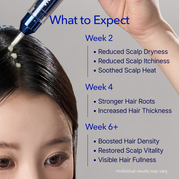 [Buy 1 Get 1] Spioxyl 400 Microneedling Hair Growth Serum