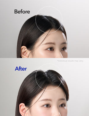 Spioxyl 400 Microneedling Hair Growth Serum
