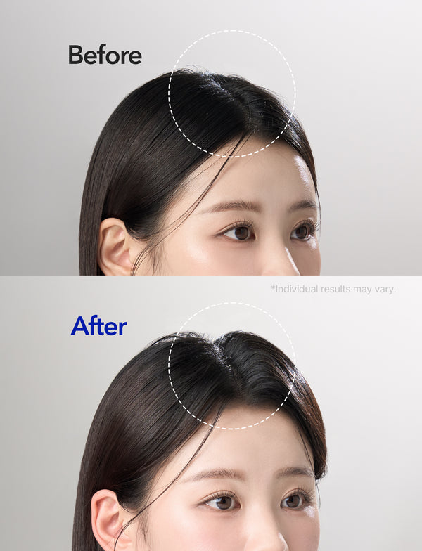 Spioxyl 400 Microneedling Hair Growth Serum