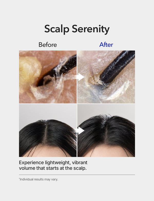 Spioxyl 400 Microneedling Hair Growth Serum