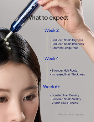 Spioxyl 400 Microneedling Hair Growth Serum