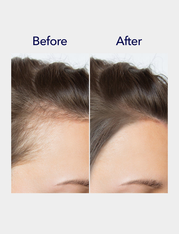 Spioxyl 800 Microneedling Hair Growth Serum