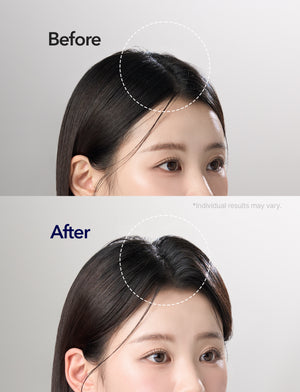 Spioxyl 400 & 800 Scalp Microneedling Repair Duo