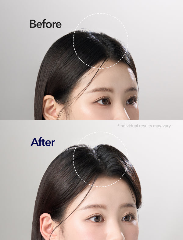 Spioxyl 400 & 800 Scalp Microneedling Repair Duo