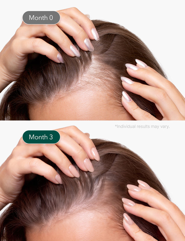 Micro Foam Scalp Treatment