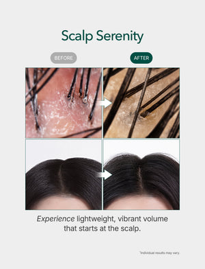 Rosemary & Caffeine Hair Growth Serum