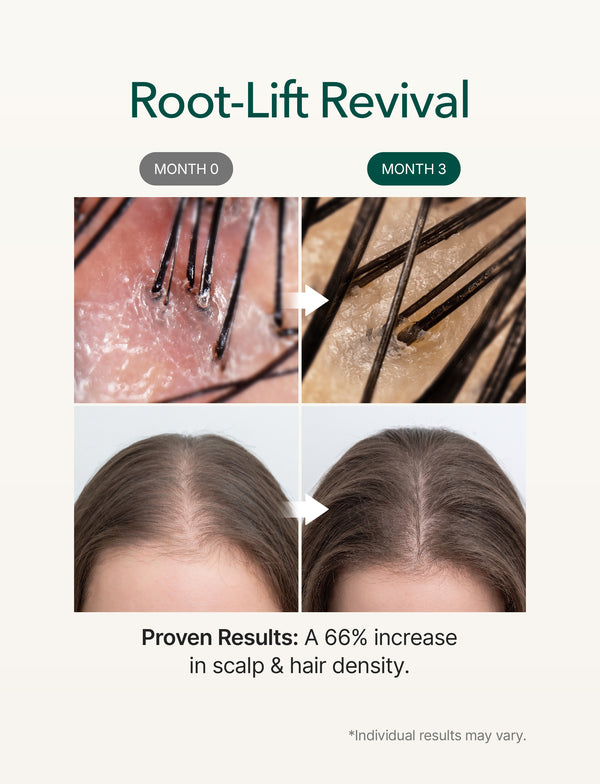 Micro Foam Scalp Treatment