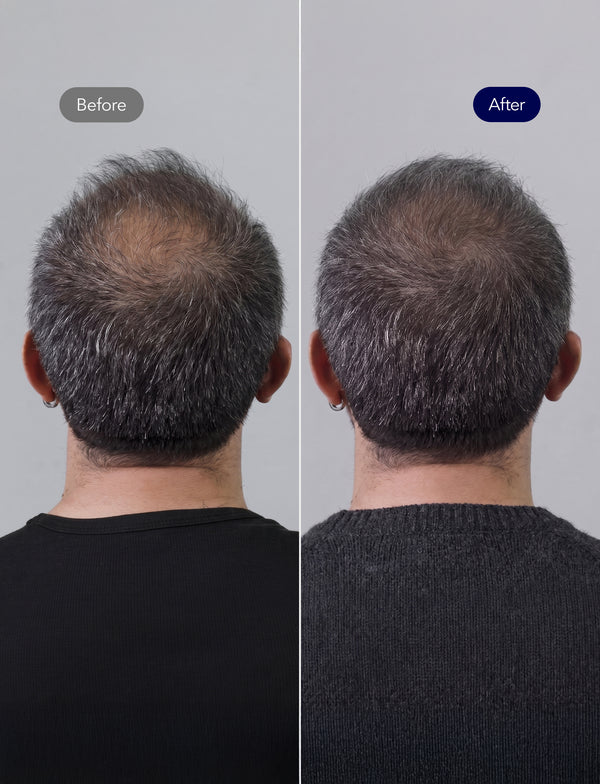Hair Strengthening Biotin Shampoo with Peptides