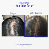 ViveLab Advanced Scalp Renewal Duo Set – 400 Daily Serum + 800 Weekly Booster for Intensive Renewal