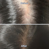 Scalp Spioxyl™ React Shot 400 – 220,000 Microneedle Formula for Visible Scalp Vitality and Fuller-Looking Hair (0.5 fl oz)