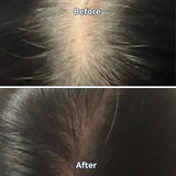 Scalp Spioxyl™ React Shot 800 – 1.6 Million Microneedle Formula for Fuller, Stronger, and Healthier-Looking Hair & Scalp (1.69 fl oz)