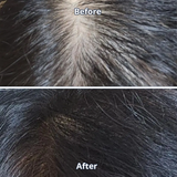 Scalp Spioxyl™ React Shot 800 – 1.6 Million Microneedle Formula for Fuller, Stronger, and Healthier-Looking Hair & Scalp (1.69 fl oz)
