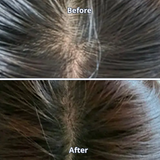 Scalp Spioxyl™ React Shot 400 – 220,000 Microneedle Formula for Visible Scalp Vitality and Fuller-Looking Hair (0.5 fl oz)
